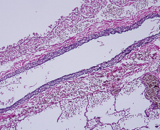 Richard-Allan Scientific Elastic Stain