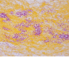 Richard-Allan Scientific Gram Stain (Tissue)