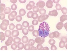 Richard-Allan Scientific Wright-Giemsa Stain