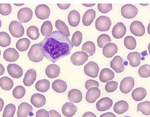 Richard-Allan Scientific Three-Step Stain